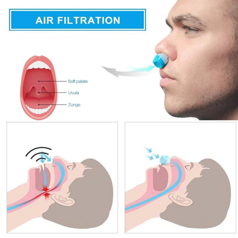 💥THE FIRST HOSELESS, MASKLESS, MICRO-CPAP ANTI SNORING